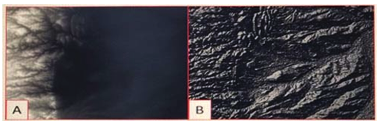 Refer to the exhibit.   Which raster function will display image A as image B? A)  Shaded Relief B)  Slope C)  Hillshade D)  Aspect