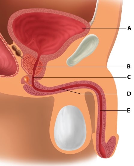 A 45-year-old man is brought to the emergency department after a motor vehicle accident.  He is unable to void and complains of a full bladder sensation.  Foley catheter placement is attempted, but the procedure is aborted once resistance is encountered and the patient begins complaining of pain.  A CT scan of his chest, abdomen, and pelvis shows a left hemothorax and pelvic fracture.  This patient is most likely to have an injury involving which of the following portions of the urogenital tract?   A) A B) B C) C D) D E) E