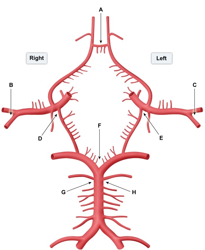 A 55-year-old right-handed man arrives at the emergency room with a severe, throbbing right-sided headache and double vision. His medical history includes uncontrolled hypertension and a long history of cigarette usage. A neurologic evaluation reveals that he is awake, attentive, and oriented, as well as capable of following orders. Both the visual fields and the optic fundi are normal. The right eye is down and out with ipsilateral ptosis, and the right pupil is dilated and nonresponsive to light and accommodation. The examination of the left eye is normal. Based on this patient's neurologic impairments, which of the following regions in the picture below is most likely to disclose an aneurysm?   A) A B) B C) C D) D E) E F) F G) G H) H