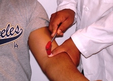A 46-year-old man comes to the office with left upper limb weakness and numbness.  He has had chronic neck pain since being involved in a motor vehicle collision 4 years ago.  He has no other medical problems.  Neurological evaluation reveals that the tendon reflex shown in the image below is absent.  Reflexes in the right upper extremity and both lower extremities are normal.   Imaging studies reveal degenerative changes in the spine causing mild spinal cord compression.  Which of the following spinal segments is most likely affected in this patient? A) C3-C4 B) C5-C6 C) C7-C8 D) C8-T1 E) T1-T2