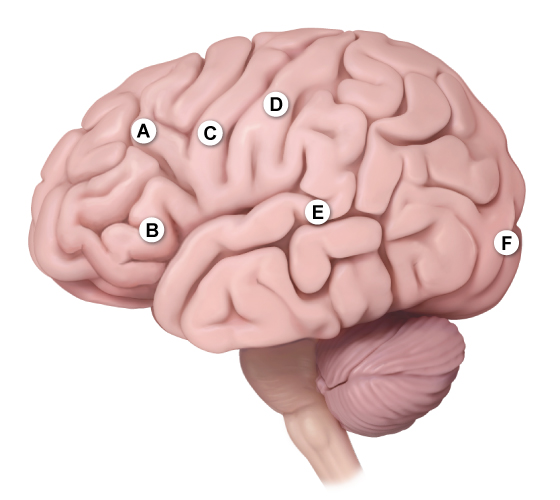 A 55-year-old right-handed man arrives at the emergency department complaining of continuous right arm tingling and numbness for many hours. There is no headache, muscular weakness, slurred speech, or trouble walking in this patient. He has a history of hypertension, paroxysmal atrial fibrillation, and ischemic stroke, all of which have resolved. He was taken off anticoagulants two months ago after suffering a gastrointestinal hemorrhage. The blood pressure is 150/90 mm Hg, and the pulse rate is 92 beats per minute. During the examination, the patient's right arm paresthesia extends to the full right side of his body, and he experiences right-sided convulsions, which are followed by a bilateral tonic-clonic seizure. Which of the following structures in the left cerebral hemisphere is most likely to be the source of this patient's seizure?   A) A B) B C) C D) D E) E F) F