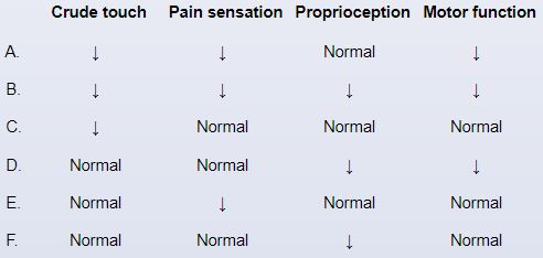A 58-year-old man had a descending thoracic aortic aneurysm repaired surgically. There are no intraoperative problems, but the patient develops new-onset neurologic impairments after surgery. The brain imaging is normal, but an MRI of the lower thoracic spinal cord indicates an ischemic infarction in the locations depicted in the example below.   Lower extremity examination of this patient is most likely to show which of the following neurologic findings?   A) A B) B C) C D) D E) E F) F