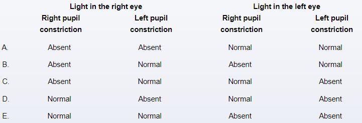A 23-year-old woman is suffering from severe visual neuritis. She has had relapsing-remitting multiple sclerosis in the past. Her brain MRI indicates a demyelination region affecting the right optic nerve. Which of the following is most likely to be discovered after a thorough examination of both eyes?   A) A B) B C) C D) D E) E
