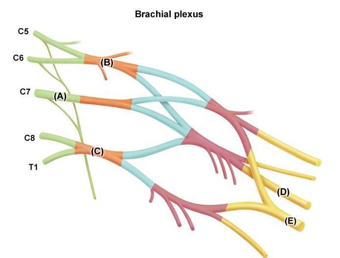 <strong>A 54-year-old man arrives at the clinic complaining of excruciating discomfort in his left neck and shoulder area for several months. He has also experienced numbness and weakness in his left hand. The patient has no recollection of any big trauma and no prior medical concerns. He attempted chiropractic and massage treatments, but the problems remained. The left upper extremity examination reveals diminished feeling in the palm, index, and middle fingers, as well as weakness in the left wrist extension. The deep tendon reflexes of the left biceps and brachioradialis are normal, while the triceps reflex is weak. The evaluation of the right upper extremity is normal. The most likely cause of this patient's neurologic symptoms is a lesion affecting which of the following identified parts of the brachial plexus?  </strong> A)A B)B C)C D)D E)E <div style=padding-top: 35px> 