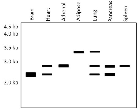 A researcher is studying the expression pattern of a particular gene.  Messenger RNA is isolated from several tissues, subjected to electrophoresis, blotted, and probed with radiolabeled DNA containing sequences from exon 4 from that gene.  An x-ray film is then placed over the blotting membrane, with the results of the autoradiogram shown below:    Which of the following best explains the autoradiogram findings in the different tissues? A) Alternate RNA splicing B) DNA rearrangement C) DNA mutation D) Enhancer effect E) Transcription factor effect