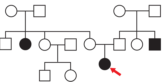 A patient is suspected of having an inherited disorder.  Pedigree analysis shows the following pattern:   This patient most likely has which of the following conditions? A) Classic galactosemia B) Hemophilia B C) Huntington disease D) Leber hereditary optic neuropathy E) Rett syndrome