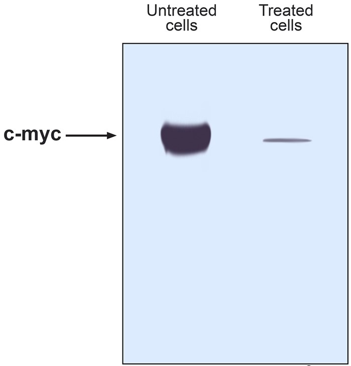 <strong>A pharmaceutical corporation investigating new therapeutic agents for treatment of Burkitt lymphoma synthesizes a double-stranded RNA molecule that is 21 base pairs in length.  The RNA molecule has a base pair sequence that is complementary to a region of mRNA encoding c-Myc.  Introduction of the RNA molecule into tumor cells results in a significant reduction in cell growth.  Western blot analysis of equivalent numbers of treated and untreated cells is shown below.   Which of the following processes was most likely directly interrupted in the cells exposed to the RNA molecule?</strong> A)DNA replication B)DNA transcription C)mRNA translation D)Proteasome activity E)Splicing <div style=padding-top: 35px> 