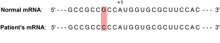 A 16-year-old girl with a history of anemia since childhood is evaluated for a genetic abnormality after several members of her family are also found to be anemic.  It is determined that she has a point mutation in the β globin gene, which has resulted in the substitution of guanine (G) with cytosine (C) in the mRNA sequence shown below (+1 position indicates start codon).   Which of the following cellular processes is most likely impaired due to this patient's gene mutation? A)Co-translational protein targeting to endoplasmic reticulum B)Initiation of translation C)Peptide bond formation D)Ribosomal translocation during polypeptide elongation E)Termination of polypeptide synthesis<div style=padding-top: 35px> 