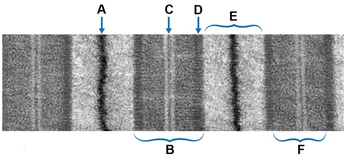 A researcher is investigating the structure of the sarcomere using skeletal muscle obtained from an experimental animal.  He develops monoclonal antibodies directed against a specific skeletal muscle protein and finds that these antibodies disrupt the binding of actin to structural support elements within the sarcomere.  Electron microscopy of the sarcomere is shown in the image below.   Which of the following labeled regions do these antibodies most likely bind? A) A B) B C) C D) D E) E F) F