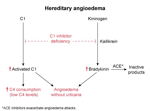 B   This patient's recurrent facial swelling is most likely due to <strong>hereditary angioedema</strong>, which is characterized by a <strong>deficiency</strong> or dysfunction of <strong>C1 inhibitor</strong> (previously referred to as C1 esterase inhibitor).  Poor C1 inhibitor function leads to elevated bradykinin, a peptide that causes vasodilation and increased vascular permeability, resulting in edema. Presentation is typically in childhood or adolescence with episodes of <strong>swelling</strong> affecting the skin (eg, face, extremities) and mucosa of the gastrointestinal tract and/or larynx.  Attacks are often precipitated by minor trauma (eg, dental procedure) or emotional stress and are <strong>not associated</strong> with itching or urticaria. Initial evaluation of hereditary angioedema is with complement testing.  <strong>Low C4</strong> is characteristic because, in the absence of C1 inhibitor, unregulated activation of C1 leads to <strong>excess activated C1</strong> and, in turn, unchecked cleavage of C4.  Diagnosis is confirmed by a decrease in functional C1 inhibitor level. <strong>(Choices A and E)</strong>  Elevated eosinophils and IgE are associated with allergic conditions.  In contrast to bradykinin-mediated hereditary angioedema, allergic angioedema (eg, anaphylaxis) is due to histamine release from activated mast cells and presents with pruritis and urticaria in addition to swelling. <strong>(Choice C)</strong>  C8 is involved in the formation of the membrane attack complex, which, when deficient, results in increased susceptibility to Neisseria infections.  Deficiency of terminal complement components (C5, C6, C7, C8, C9) does not occur with hereditary angioedema because the upstream complement fragments (C2b, C4b) are rapidly inactivated in the plasma. <strong>(Choice D)</strong>  Selective IgA deficiency increases risk for anaphylaxis, which can cause angioedema.  However, this risk is only with transfusion of blood products and would present with other organ system involvement (eg, bronchospasm, hypotension, urticaria).  IgA deficiency is also associated with certain autoimmune conditions (eg, celiac disease, systemic lupus erythematosus), but none of these would present with isolated facial swelling. <strong>Educational objective:</strong> Hereditary angioedema is characterized by recurrent episodes of cutaneous and/or mucosal swelling due to C1 inhibitor deficiency.  C4 levels are low due to uninhibited cleavage of C4 by excess activated C1.
