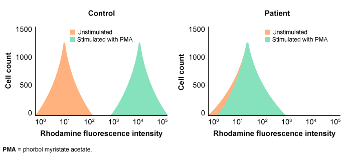 <strong>A 15-month-old boy is brought to the emergency department due to fever and foot swelling.  The patient first developed swelling of the right foot and fever 4 days ago.  Today, swelling of the left foot also developed.  Medical history is significant for a perianal abscess at 9 months of age.  Imaging studies reveal osteomyelitis affecting the metatarsal bones of both feet.  Intravenous antimicrobials are administered, but the patient still has fever and bilateral foot swelling 2 weeks later.  Laboratory workup shows persistent neutrophilic leukocytosis.  Bone biopsy culture grows Staphylococcus aureus.  Evaluation for an underlying diagnosis is initiated; via use of a rhodamine derivative, the patient's peripheral blood is stimulated with phorbol myristate acetate (PMA) and compared with a control.  Results of the test are shown in the image below:   Which of the following processes is most likely impaired in this patient?</strong> A)Chemotaxis B)Complement production C)Opsonization D)Phagocytic metabolism E)T-lymphocyte function <div style=padding-top: 35px> 