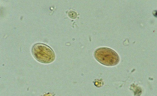 A 32-year-old man comes to the office due to diarrhea, flatulence, foul-smelling stools, and abdominal cramping.  He recently returned home from a hiking trip.  A smear of his stool sample is shown below:   Which of the following is the drug of choice for this condition? A) Ciprofloxacin B) Metronidazole C) Mebendazole D) Albendazole E) Loperamide F) Clindamycin G) Erythromycin