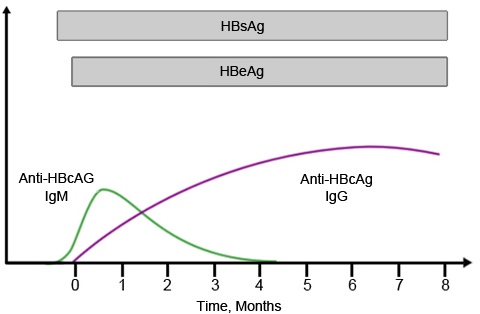 A 25-year-old man is hospitalized with fever, anorexia, and fatigue.  He admits to IV drug abuse and many episodes of unprotected sex over the past few years.  His condition is treated and he is discharged from the hospital.  The patient follows up with his physician regularly over the next 8 months, and the following serologic marker dynamics are obtained (see the graph below) .   *Grey bars indicate the detectable presence of the specified serum marker.This patient most likely: A) Had acute hepatitis B and has successfully recovered B) Had an exacerbation of preexisting hepatitis B C) Had acute hepatitis B that has progressed to chronic hepatitis with low infectivity D) Had acute hepatitis B that has progressed to chronic hepatitis with high infectivity E) Was vaccinated against HBV during the hospitalization
