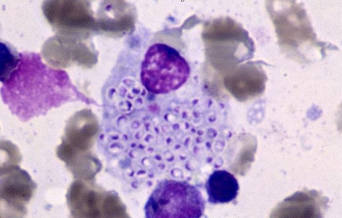 A 54-year-old man with HIV comes to the emergency department due to nonproductive cough, low-grade fevers, and worsening fatigue for the past month.  He has also lost 3.6 kg (8 lb)  over the same period.  The patient does not take antiretroviral therapy consistently and has not followed up with his primary care physician for the past several months.  Physical examination reveals hepatosplenomegaly.  Laboratory testing shows pancytopenia and elevated liver aminotransferases.  Bone marrow aspiration is performed, and light microscopy of the specimen is shown below.   Which of the following is the most likely cause of this patient's current condition? A) Aspergillus fumigatus B) Blastomyces dermatitidis C) Candida albicans D) Coccidioides immitis E) Cryptococcus neoformans F) Histoplasma capsulatum