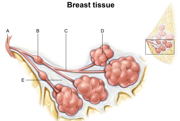 A 50-year-old woman, gravida 0 para 0, comes to the office for a well visit.  She has no family history of cancer.  Breast examination is normal.  The patient has a screening mammography that reveals microcalcifications.  Due to this finding, she undergoes a breast biopsy.  Histopathology reveals ducts distended by pleomorphic cells with prominent central necrosis.  The lesion does not extend beyond the ductal basal membrane.  Which of the following is most likely the origin of the lesion?   A) A B) B C) C D) D E) E