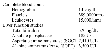 A 32-year-old man comes to the office due to fever, jaundice, vomiting, and decreased appetite for the past 5 days.  He recently returned home from South America and reports that a couple of his travel companions have had similar symptoms.  The patient does not use alcohol, tobacco, or illicit drugs and has no relevant family history.  Temperature is 38.8 C (101.8 F) , blood pressure is 125/80 mm Hg, pulse is 85/min.  Scleral icterus and hepatomegaly are present.  Laboratory results are as follows:   Which of the following pathophysiologic events is most likely occurring in this patient? A) Accumulation of misfolded protein within hepatocytes B) CD8<sup>+</sup> T-cell response against affected hepatocytes C) Neutrophilic infiltration of the liver D) Periportal lymphoplasmacytic infiltration E) Transformation of hepatic stellate cells into myofibroblasts