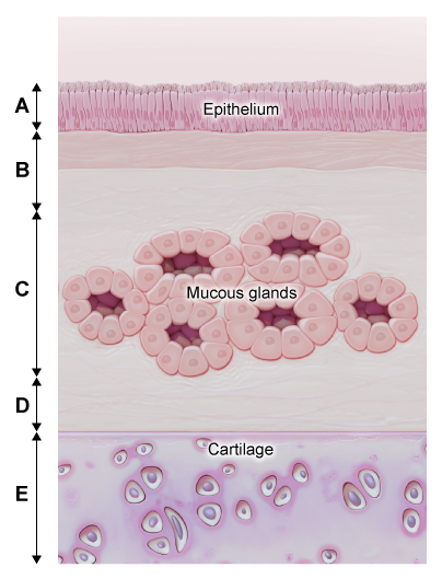 A 56-year-old man is evaluated for dyspnea, wheezing, and cough productive of yellow sputum.  The patient reports that he has been treated with antibiotics when the dyspnea is severe.  He has smoked 2 packs of cigarettes daily for the past 25 years.  The schematic diagram below is a representation of a bronchial wall.  Which of the following ratios is the best pathological index to determine the severity of this patient's disease?   A) A / (A+B+C+D)  B) A / (A+B+C+D+E)  C) C / (B+C+D)  D) C / (A+B+C+D+E)  E) (B+C+D)  / (A+B+C+D+E) 