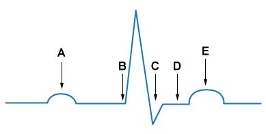 A 21-year-old man comes to the office due to recurrent heart palpitations that start and stop abruptly.  After initial workup, the physician suspects that there is an abnormal conduction pathway in this patient's heart that bypasses the atrioventricular node.  Assuming the diagnosis is correct, which part of the patient's ECG is most likely to be affected during normal sinus rhythm?   A) A B) B C) C D) D E) E