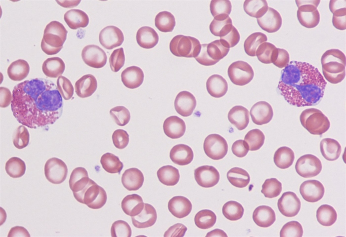 A 48-year-old man is evaluated for shortness of breath and dry cough for 1 week.  The patient has never had similar symptoms in the past and takes no medications.  He has a 5-pack-year smoking history and does not use alcohol or illicit drugs.  The patient is a pig farmer in Ohio and has not traveled recently.  Temperature is 37.8 C (100 F) , blood pressure is 128/85 mm Hg, pulse is 95/min, and respirations are 16/min.  Lung auscultation reveals scattered wheezing and crackles.  Peripheral blood smear is shown below.   The nucleated cells seen on this patient's peripheral smear most likely perform which of the following functions? A) Bacterial opsonization B) Destruction of helminths C) Inhibition of fungal growth D) Killing of virus-infected cells E) Stimulation of fibroblasts