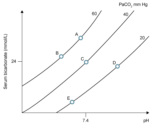 A 28-year-old man is found unresponsive by his roommate and is brought to the emergency department.  He has a history of injection drug use.  On physical examination, the patient is obtunded and hypopneic.  The pupils are pinpoint.  Lung auscultation reveals decreased breath sounds bilaterally.  Endotracheal intubation is planned for airway protection and arterial blood gas analysis is performed prior to the procedure while the patient is breathing room air.  This patient's current acid-base status is best represented by which of the following points on the below graph?   A) A B) B C) C D) D E) E