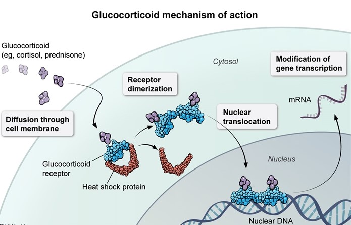 B   This patient has chronic right lower abdominal pain with tenderness and intermittent diarrhea, symptoms that raise suspicion for <strong>Crohn disease</strong> with ongoing active inflammation.  Patients with mild Crohn disease (eg, limited area of inflammation, no evidence of systemic involvement) are often treated with a targeted-release glucocorticoid such as budesonide to reduce inflammation and induce disease remission. <strong>Glucocorticoids</strong>, like many other lipid-derived hormones (eg, progesterone, estrogen), bind to a <strong>cytosolic receptor</strong> rather than a cell surface receptor.  The glucocorticoid-receptor complex can then <strong>translocate</strong> into the nucleus, bind to the relevant DNA regions, and cause a tissue-specific alteration in transcription.  In immune cells, the effects of glucocorticoids include <strong>inhibition</strong> of proinflammatory transcription factors such as nuclear factor-kappa-B <strong>(NF-κB)</strong>, which results in reduced expression of cytokines and inflammatory mediators (eg, TNF-alpha) along with decreased immune cell survival and propagation. Oral <strong>budesonide </strong>(often given in a delayed-release preparation that targets the ileum) is especially useful in Crohn disease because it has high topical potency and <strong>less systemic adverse effects</strong> than other glucocorticoids (eg, prednisone) due to <strong>high first-pass metabolism</strong>. <strong>(Choices A and E)</strong>  Azathioprine and mycophenolate can be used to reduce inflammation in patients with moderate-severe Crohn disease by inhibition of de novo purine synthesis, which immune cells (eg, B and T cells) are especially dependent on during proliferation.  Both agents inhibit key enzymes in the purine synthesis pathway (which occurs in the cytosol) rather than inhibiting transcription factors. <strong>(Choice C)</strong>  Although infliximab can be used to induce remission in patients with moderate-severe Crohn disease, it is a monoclonal antibody that reduces inflammation by binding to and inhibiting the proinflammatory effects of tumor necrosis factor-alpha (TNF-alpha), a cytokine that is primarily found extracellularly. <strong>(Choice D)</strong>  Methotrexate and its breakdown products are folic acid analogues that can reduce inflammation by competitively inhibiting multiple folate-dependent enzymes rather than inhibiting transcription factors. <strong>Educational objective:</strong> Budesonide, like other glucocorticoids, reduces inflammation by binding to a cytosolic receptor, translocating into the nucleus, and inhibiting proinflammatory transcription factors such as nuclear factor-kappa-B (NF-κB).  It is especially useful in reducing transmural bowel inflammation in patients with Crohn disease because it has high topical potency and limited systemic adverse effects due to high first-pass metabolism.