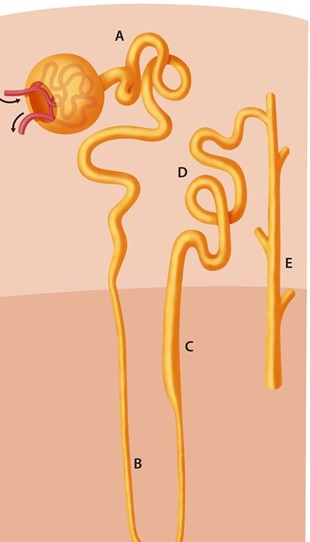 A 57-year-old man with acute ipsilateral headache and right-sided eye discomfort visits the emergency room. The patient also describes having extreme nausea and seeing  halos  surrounding everything. His discomfort is less intense following first therapy with the proper medicines. He also has increased diuresis and urine that is quite alkaline. Which of the following nephron segments is most frequently affected by the medication used to treat this patient's eye condition?   A) A B) B C) C D) D E) E