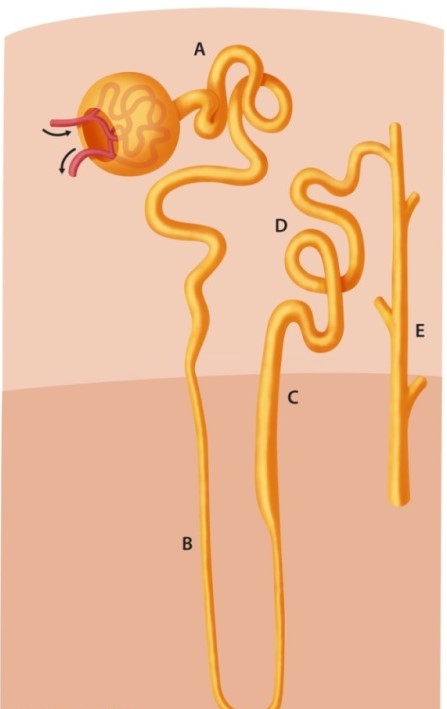 A 62-year-old man comes to the emergency department with severe shortness of breath and orthopnea.  His medical history is significant for long-standing hypertension and myocardial infarction a year ago.  Physical examination reveals elevated jugular venous pressure, crackles on lung auscultation, and pitting edema of the lower extremities.  The patient is given a medication and experiences brisk diuresis with significant symptom relief.  The drug most likely used to treat this patient's condition predominantly acts on which of the following nephron segments?   A) A B) B C) C D) D E) E