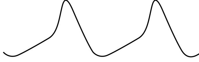 <strong>A 43-year-old man is evaluated for occasional palpitations provoked by anxiety. The patient describes a sudden-onset pounding sensation in the chest followed by lightheadedness and shortness of breath. He has never had syncope. The patient has no history of heart disease, and family history is unremarkable. After initial evaluation, he is treated with verapamil and reports marked improvement in the frequency of palpitation episodes. The tracing below shows the electrical activity of a specific type of cardiac cell in the patient's heart. Which of the following effects would verapamil administration most likely have on these cells?</strong> A)Decreased excitation and contraction coupling B)Increased action potential amplitude C)Lowered threshold potential D)Reduced refractory period E)Slowed spontaneous depolarization