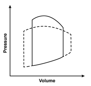 <strong>A 44-year-old man is hospitalized with multiple injuries following a motor vehicle collision. An arteriovenous fistula created by an injury would most likely result in which of the following changes to the left ventricular pressure-volume loop?Solid line = preinjury Dashed line = postinjury</strong> A) B) C) D)
