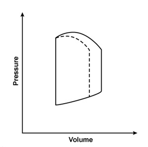 <strong>A 44-year-old man is hospitalized with multiple injuries following a motor vehicle collision. An arteriovenous fistula created by an injury would most likely result in which of the following changes to the left ventricular pressure-volume loop?Solid line = preinjury Dashed line = postinjury</strong> A) B) C) D)