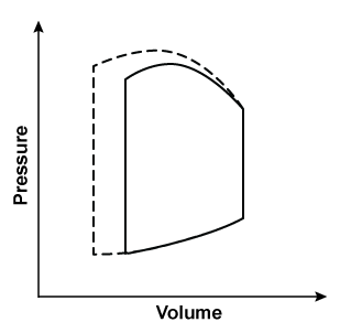 <strong>A 54-year-old man is admitted to the hospital due to cough, shortness of breath, and chest discomfort. He has a known history of coronary artery disease and underwent coronary artery bypass graft surgery 3 years ago. As a result of drug therapy, the left ventricular pressure-volume loop changes from a solid to a dashed line, as shown in the graph below (the loop is unchanged in areas where no dashed line is seen): Which of the following parameters is most likely increased as a result of this change?</strong> A)End-diastolic pressure B)End-systolic volume C)Stroke volume D)Ventricular compliance E)Ventricular preload