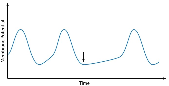 <strong>Electrophysiologists conduct a study in which they record the membrane potential changes of cardiac cells while exposing them to various agents. A tracing from one of the experiments is shown below. Which of the following substances was most likely applied to the cells at the point indicated by the arrow?</strong> A)Adenosine B)Aldosterone C)Angiotensin II D)Glucagon E)Glycine F)Norepinephrine