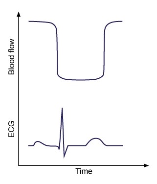 <strong>A large pharmaceutical company is conducting research on an experimental drug that affects blood flow in diseased tissue. A healthy 30-year-old man is enrolled in the trial, and patterns of normal blood flow through various tissues are studied. One of the patterns is shown in the image below: The blood flow curve was most likely obtained from tissue of which of the following?</strong> A)Adrenal medulla B)Brain cortex C)Left ventricular myocardium D)Renal cortex E)Renal medulla F)Right ventricular myocardium G)Subcortical nuclei