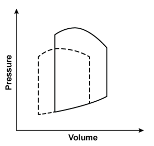 <strong>A 45-year-old man comes to the emergency department due to a 2-day history of dyspnea, orthopnea, and ankle swelling. This morning, he also had nausea, vomiting, and a headache. Blood pressure is elevated, and physical examination shows pulmonary crackles and bilateral pitting edema up to the knees. A sodium nitroprusside infusion is begun. Which of the following left ventricular pressure/volume relationships best represents the effects of this therapy?*Solid line = before nitroprusside; dashed line = during nitroprusside infusion.</strong> A) B) C) D) E)