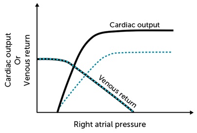 The cardiac output and venous return curves of a healthy person are shown below with solid lines.   Which of the following is the most likely cause of the change depicted by the dashed lines? A) Excessive hydration B) Acute hemorrhage C) Chronic anemia D) Myocardial infarction E) Anaphylaxis