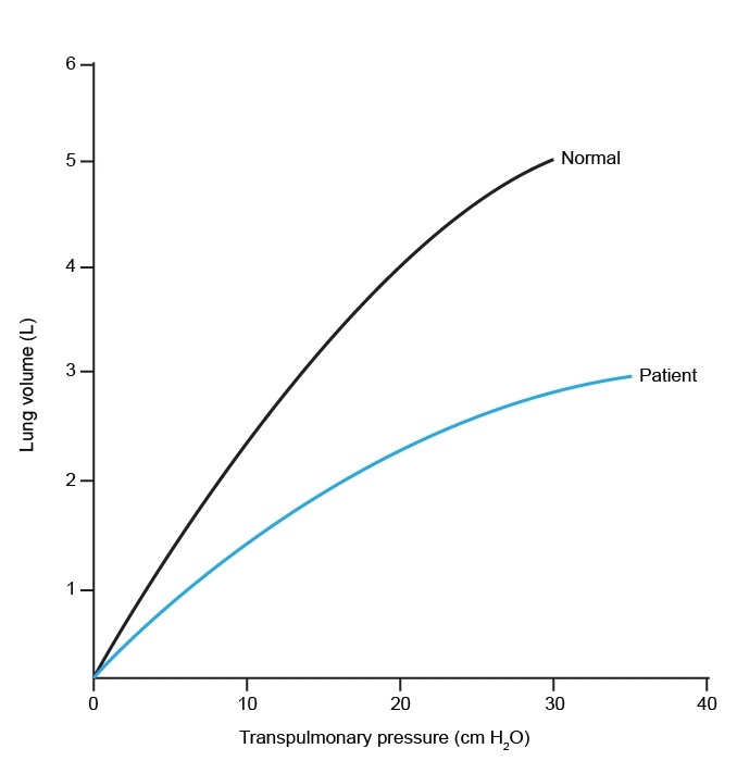 <strong>A 43-year-old patient with dyspnea visits the doctor. The pressure/volume relationship in healthy lung tissue is represented by the black curve in the image below. The patient's lung tissue's pressure/volume connection is shown by the blue curve.   Which of the following is the most likely cause of this patient's symptoms?</strong> A)Alpha-1 antitrypsin deficiency B)Bronchial asthma C)Fibromyalgia D)Idiopathic pulmonary arterial hypertension E)Pulmonary fibrosis <div style=padding-top: 35px> 