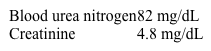 A 64-year-old man comes to the hospital due to generalized weakness and fatigue for the past several weeks.  He has a history of uncontrolled hypertension and nonadherence to medical therapy.  Blood pressure is 160/100 mm Hg, pulse is 90/min, and respirations are 22/min.  Oxygen saturation is 95% on room air.  Physical examination shows elevated jugular venous pressure, bilateral crackles, and 3+ pitting edema in both legs.  Laboratory results are as follows:   Which of the following additional findings are most likely present in this patient?   A) A B) B C) C D) D E) E