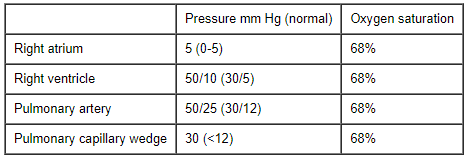An 83-year-old woman is brought to the emergency department due to chest pressure accompanied by nausea and vomiting.  She felt well until 3 days ago when she was watching television and experienced substernal chest discomfort that radiated to her back.  The pain lasted nearly an hour before resolving spontaneously; she also had nausea and vomiting at that time.  The patient has never had chest pain before and has had no further discomfort since.  She attributes the entire experience to drinking expired milk.  The patient is currently without symptoms but is seen in the emergency department at the insistence of her daughter, who is a physician.  Other medical problems include overactive bladder and osteoarthritis.  Medications include oxybutynin and ibuprofen as needed. Blood pressure is 110/75 mm Hg, pulse is 61/min, and respirations are 12/min.  The patient is in no acute distress.  Jugular venous pulsations are normal.  Lungs are clear to auscultation bilaterally.  Apical impulse is normal.  No heart murmurs are heard.  Pulses are 2+ and symmetrical.  There is no edema. ECG shows normal sinus rhythm with 2-mm Q waves in leads II, III, and aVF.  Laboratory results are as follows:   The patient is admitted to the intensive care unit and scheduled for coronary angiography.  Shortly after arriving on the floor, she is noted to be markedly dyspneic.  Repeat blood pressure is 90/45 mm Hg, pulse is 125/min, and respirations are 20/min.  Lung examination reveals bilateral diffuse crackles.  A pulmonary arterial catheter is placed, with the results shown below.   Which of the following is the most likely diagnosis in this patient? A) Left ventricular aneurysm B) Papillary muscle rupture C) Pulmonary embolism D) Right ventricular infarction E) Ruptured ventricular septum