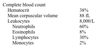 <strong>A 60-year-old man is hospitalized for acute pancreatitis.  He reports swelling and tenderness in his jaw that appeared 6 months ago.  He has no medical problems, takes no medications, and does not use tobacco, alcohol, or illicit drugs.  There is no history of trauma to the abdomen.  He does not have dry eyes or dry mouth.  On admission, ultrasound of the abdomen shows no gallstones.  CT of the abdomen reveals a 3x4-cm solid mass in the mid-portion of his pancreas with some surrounding edema.  Chest CT reveals bilateral hilar adenopathy.  He is started on intravenous fluids, opioids for pain control, and nothing by mouth, and his abdominal pain resolves. On examination, he is well-nourished and appears comfortable.  His blood pressure is 133/78 mm Hg, pulse is 90/min, and oxygen saturation is 98% on room air.  There is bilateral enlargement of his parotid glands and some enlargement of his lacrimal glands.  The remainder of his examination is within normal limits. Laboratory results are as follows:   Serum chemistry and fasting lipid panels, liver function tests, urinalysis, and erythrocyte sedimentation rate are all within normal limits.  HIV testing is negative. Which of the following conditions is the most likely cause of this patient's presentation?</strong> A)IgG4-related disorder B)Large B cell lymphoma C)Occult alcoholism D)Pancreatic carcinoma E)Sjögren's syndrome <div style=padding-top: 35px> 