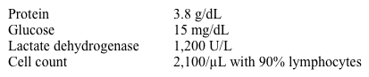 A 53-year-old woman is evaluated for fatigue, malaise, and exertional shortness of breath.  She describes a dry cough that has been present over the last year and frequent joint pain and swelling in her hands and wrists.  She has no other medical problems and is a lifetime non-smoker.  The patient emigrated from Ecuador 3 months ago.  Tuberculosis and HIV testing done for immigration screening 6 months ago were normal. Vital signs are within normal limits.  Her body mass index is 20 kg/m<sup>2</sup>.  There is a 2/6 mid-systolic murmur at the right upper sternal border.  Breath sounds are decreased at the right lung base.  There are no skin rashes or peripheral edema.  The patient has mild synovitis involving bilateral metacarpophalangeal joints. Her hemoglobin is 10.2 g/dL and mean corpuscular volume is 85 fL.  Chest x-ray shows a moderate right-sided pleural effusion.  Thoracentesis shows yellow-greenish fluid with the following results:   Which of the following is the most likely cause of this patient's pleural effusion? A) Empyema B) Hypothyroidism C) Pulmonary hypertension D) Rheumatoid arthritis E) Sarcoidosis