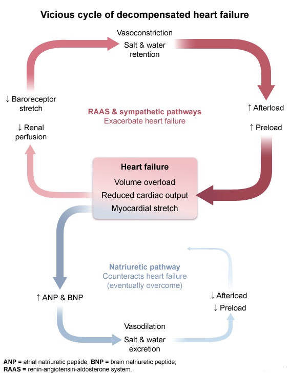 A Explanation:   This patient's presentation with exertional dyspnea, cough, orthopnea, and evidence of pulmonary and peripheral edema following recent myocardial infarction is consistent with <strong>decompensated heart failure</strong> (DHF).&nbsp; The initial disturbance in heart failure is usually a reduction in left ventricular function that leads to <strong>reduced cardiac output</strong>.&nbsp; The reduced cardiac output causes decreased organ and tissue perfusion that is sensed by arterial baroreceptors and the juxtaglomerular apparatus of the kidneys, which triggers <strong>compensatory activation</strong> of the <strong>sympathetic nervous system</strong> and <strong>renin-angiotensin-aldosterone system</strong> (RAAS).&nbsp; These systems stimulate both <strong>vasoconstriction</strong> and <strong>sodium retention</strong> (ie, increased blood volume) to maintain organ and tissue perfusion.&nbsp; Specifically, angiotensin II causes vasoconstriction of both the afferent and efferent renal arterioles (more prominent of the efferent arterioles) to maintain the glomerular filtration rate. RAAS Ultimately, these compensatory mechanisms are <strong>maladaptive</strong> as vasoconstriction increases afterload and sodium retention increases preload, both of which place additional strain on the failing heart and further reduce cardiac output.&nbsp; A vicious cycle ensues, eventually progressing to clinical decompensation with overt volume overload. <strong>(Choice B)</strong>&nbsp; Plasma colloid pressure is mostly driven by albumin concentration.&nbsp; It is low in nephrotic syndrome and decompensated cirrhosis, but it is typically normal in DHF.&nbsp; Edema in DHF results from elevated venous hydrostatic pressure. <strong>(Choice C)</strong>&nbsp; Renal venous pressure is increased in DHF as elevated pressure is transmitted back from the heart to the vena cava and to the renal veins (ie, central venous pressure is elevated). <strong>(Choices D, E, and F)</strong>&nbsp; The release of natriuretic peptides is triggered by myocardial stretch; these peptides stimulate renal afferent arteriole vasodilation and sodium excretion to counteract the sympathetic and RAAS pathways and offset the downward spiral of DHF.&nbsp; However, the natriuretic pathway is eventually overcome.&nbsp; Renal arteriolar vasoconstriction predominates with reduced renal blood flow and reduced glomerular filtration (ie, reduced sodium delivery to the distal tubule, reduced chloride delivery to the macula densa). <strong>Educational objective:</strong> Decompensated heart failure involves the activation of compensatory mechanisms in the form of the sympathetic nervous system and renin-angiotensin-aldosterone system.&nbsp; These systems stimulate vasoconstriction and sodium retention to maintain organ and tissue perfusion in the setting of reduced cardiac output.&nbsp; The compensatory mechanisms are ultimately maladaptive as they further decrease cardiac output and perpetuate a downward spiral of clinical decompensation. References: Congestive heart failure: pathophysiologic consequences of neurohormonal activation and the potential for recovery: part I. (http://www.ncbi.nlm.nih.gov/pubmed/22030844)