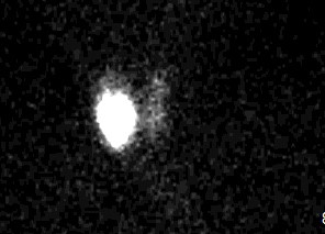 A 31-year-old woman comes to the office with a 3-month history of palpitations and weight loss.  She weighs 110 kg (243 lb) ; 3 months ago, she weighed 118 kg (260 lb) .  There is no associated dysphagia, neck pain, or hoarseness, and her menstrual periods have been regular.  The patient was previously healthy and her family history is unremarkable.  She does not use tobacco or alcohol.  The patient is sexually active with one partner and uses a barrier method for contraception.  Temperature is 36.7 C (98.1 F) , blood pressure is 140/90 mm Hg, pulse is 102/min, and respirations are 20/min.  The thyroid gland cannot be clearly felt on examination due to body habitus.  Ocular examination is unremarkable.  Laboratory tests show an elevated serum free triiodothyronine and thyroxine and low TSH.  A urine pregnancy test is negative.  Radioactive iodine scan reveals uptake of tracer only in the right thyroid lobe, as shown in the image below.   Which of the following processes is responsible for this patient's elevated thyroid hormone levels? A) Antibody-stimulated thyroid hormone production B) Autonomous thyroid hormone production C) Exogenous thyroid hormone intake D) Pituitary dysfunction E) Release of preformed thyroid hormone