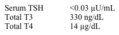 A 36-year-old woman comes to the office due to weight loss.  She has lost 5 kg (11 lb)  over the last 3 months associated with palpitations, heat intolerance, persistent tremors, and excessive sweating.  Past medical and family histories are unremarkable, and the patient does not use tobacco, alcohol, or illicit drugs.  She is married and has a child.  Blood pressure is 140/70 mm Hg and pulse is 104/min and regular.  Physical examination shows a 2x2 cm nodule in the left thyroid lobe.  The rest of the thyroid gland is normal, and there is no associated cervical lymphadenopathy.  Eye examination shows minimal lid lag, but no proptosis or chemosis.  There is a fine tremor in both upper extremities.  Thyroid function test results are as follows:   Radioactive iodine scan shows uptake only in the nodule.  The patient wishes to have additional children and is concerned that she will not be able to get pregnant if she is treated for her current condition.  If left untreated, this patient is at greatest risk for developing which of the following complications? A) Bone loss B) Coronary artery disease C) Fetal hyperthyroidism D) Thyroid cancer E) Vision loss