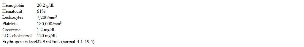 A 54-year-old woman is admitted to the hospital with a day of right-sided weakness.  The stroke team was activated, but no intervention was performed due to long length of time since symptom onset.  The patient also notes 6 weeks of headaches and generalized weakness.  She has not had recent fever, shortness of breath, cough, chest pain, palpitations, or syncope.  She has no chronic medical conditions and does not take medications.  The patient smoked a pack of cigarettes daily for 20 years but quit 15 years ago.  She does not use alcohol or illicit drugs.  Temperature is 37.1 C (98.8 F) , blood pressure is 160/96 mm Hg, and pulse is 80/min and regular.  Oxygen saturation is 99% on room air.  BMI is 25 kg/m<sup>2</sup>.  Cardiopulmonary examination shows no abnormalities.  Abdomen is soft and tender; there is no hepatosplenomegaly.  Extremities have no cyanosis, clubbing, or edema.  A right facial droop is present.  Motor strength is 2/5 in right upper extremity, 3/5 in right lower extremity, and 5/5 in left upper and left lower extremities.  Sensation is intact diffusely.  Laboratory results are as follows:   MRI of the brain reveals an acute infarction involving the left internal capsule.  Chest x-ray is normal.  ECG shows normal sinus rhythm.  Echocardiogram shows no abnormalities.  Which of the following is most likely to establish a diagnosis in this patient? A) Bone marrow aspiration B) CT scan of the abdomen C) Factor V Leiden mutation testing D) Lupus anticoagulant E) Serologic test for syphilis