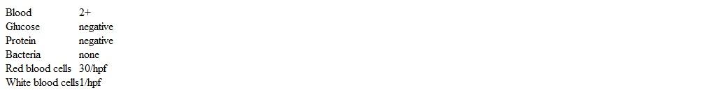 A 3-year-old boy is brought to the clinic for evaluation of red-tinged urine, which his mother noticed earlier this week.  The patient has had multiple episodes since but has no associated dysuria.  He has had no prior injury but was recently treated with antibiotics for streptococcal pharyngitis.  The patient has no chronic medical conditions and has reached all developmental milestones.  Temperature is 36.7 C (98.1 F) .  Examination shows a well-appearing and well-nourished boy.  There is a firm, nontender, palpable mass in the left abdomen.  Urinalysis reveals:   Which of the following is the most likely diagnosis for this patient? A) IgA nephropathy B) Nephrolithiasis C) Neuroblastoma D) Poststreptococcal glomerulonephritis E) Renal cell carcinoma F) Wilms tumor (nephroblastoma) 