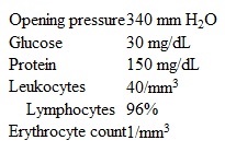 A 34-year-old man is brought to the emergency department due to 3 weeks of intermittent fever, headache, malaise, and night sweats.  Over the last few days, his headaches have worsened, and he has had blurry and double vision.  The patient uses injection drugs and was treated for staphylococcal endocarditis 4 years ago.  Temperature is 38.1 C (100.6 F) , blood pressure is 150/100 mm Hg, pulse is 66/min, and respirations are 18/min.  BMI is 18.4 kg/m<sup>2</sup>.  The patient is ill in appearance and somnolent but easily arousable and oriented.  There are white plaques on the oropharyngeal mucosa and several skin lesions resembling molluscum contagiosum.  There is increased resistance to passive neck flexion.  Neurologic examination reveals leftward gaze restriction in the left eye but no other focal weakness or sensory loss.  Funduscopy reveals bilateral papilledema.  A noncontrast CT scan of the head shows no abnormalities.  The patient receives a lumbar puncture; results of the spinal fluid analysis are as follows:    Which of the following is the best pharmacotherapy for this patient's current condition? A) Amphotericin B and flucytosine B) Aqueous crystalline penicillin G C) Ceftriaxone and vancomycin D) Ganciclovir and foscarnet E) Intravenous acyclovir
