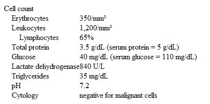 A 66-year-old man comes to the office due to 3 months of slowly worsening nonproductive cough and shortness of breath.  He has also had night sweats, excessive fatigue, and sharp, episodic right-sided chest pain.  The patient has lost approximately 5 kg (11 lb)  during this period.  He has a history of hypertension and takes chlorthalidone.  He has smoked a half-pack of cigarettes daily for the past 50 years.  The patient worked in a shipbuilding factory until his early 40s and then began working in the automobile industry.  Temperature is 36.7 C (98 F) , blood pressure is 130/80 mm Hg, pulse is 84/min, and respirations are 14/min.  No jugular venous distension or lymphadenopathy is present.  There is dullness to percussion and decreased breath sounds over the right lower chest.  Heart sounds are normal with no murmur.  The abdomen is soft and nontender with no hepatosplenomegaly.  No edema is present.  Chest imaging reveals a moderate right-sided pleural effusion with irregular pleural thickening and calcifications, but no lung parenchymal abnormalities.  A thoracentesis is performed and yields serosanguineous pleural fluid; pleural fluid analysis reveals the following:   Which of the following is the most likely cause of this patient's pleural effusion? A) Chronic silicosis B) Malignant mesothelioma C) Non-Hodgkin lymphoma D) Rheumatoid pleural effusion E) Thoracic duct obstruction