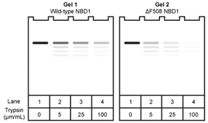 Passage The cystic fibrosis transmembrane conductance regulator (CFTR) protein is a chloride ion channel involved in the production of mucus, sweat, and digestive fluids. CFTR is composed of five domains (Figure 1) : Two transmembrane domains (TMD1 and TMD2) , two nucleotide binding domains (NBD1 and NBD2) , and one regulatory domain (R domain) . <strong>Figure 1</strong> Schematic diagram of CFTR domainsThe NBD domains regulate CFTR activity by binding ATP, which causes a conformational change in the TMD domains. This change allows chloride ions to leave cells by passively crossing the membrane down their concentration gradient. The R domain regulates activity further through dynamic phosphorylation at several positions. The movement of chloride ions facilitates the movement of water out of the cell by osmotic pressure and helps keep secretions thin.Cystic fibrosis (CF) arises from recessively inherited mutations in the CFTR gene. The most common mutation is a three-base-pair deletion that removes a phenylalanine residue at position 508 in NBD1 (ΔF508) . This mutation causes the protein to fold incorrectly, making it more susceptible to degradation by proteases. The resulting decrease in CFTR abundance inhibits chloride ion transport, leading to thickening of normally thin secretions and increased risk of life-threatening pulmonary infections. -If wild-type and ΔF508 NBD1 were isolated and incubated with increasing concentrations of the protease trypsin, which of the following SDS-PAGE gels would be consistent with the increased susceptibility of ΔF508 NBD1 to degradation? A) B) C) D)