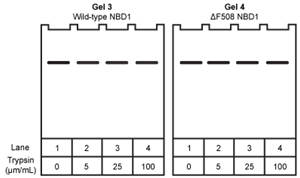 Passage The cystic fibrosis transmembrane conductance regulator (CFTR) protein is a chloride ion channel involved in the production of mucus, sweat, and digestive fluids. CFTR is composed of five domains (Figure 1) : Two transmembrane domains (TMD1 and TMD2) , two nucleotide binding domains (NBD1 and NBD2) , and one regulatory domain (R domain) . <strong>Figure 1</strong> Schematic diagram of CFTR domainsThe NBD domains regulate CFTR activity by binding ATP, which causes a conformational change in the TMD domains. This change allows chloride ions to leave cells by passively crossing the membrane down their concentration gradient. The R domain regulates activity further through dynamic phosphorylation at several positions. The movement of chloride ions facilitates the movement of water out of the cell by osmotic pressure and helps keep secretions thin.Cystic fibrosis (CF) arises from recessively inherited mutations in the CFTR gene. The most common mutation is a three-base-pair deletion that removes a phenylalanine residue at position 508 in NBD1 (ΔF508) . This mutation causes the protein to fold incorrectly, making it more susceptible to degradation by proteases. The resulting decrease in CFTR abundance inhibits chloride ion transport, leading to thickening of normally thin secretions and increased risk of life-threatening pulmonary infections. -If wild-type and ΔF508 NBD1 were isolated and incubated with increasing concentrations of the protease trypsin, which of the following SDS-PAGE gels would be consistent with the increased susceptibility of ΔF508 NBD1 to degradation? A) B) C) D)