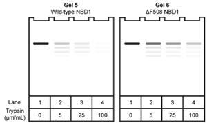 Passage The cystic fibrosis transmembrane conductance regulator (CFTR) protein is a chloride ion channel involved in the production of mucus, sweat, and digestive fluids. CFTR is composed of five domains (Figure 1) : Two transmembrane domains (TMD1 and TMD2) , two nucleotide binding domains (NBD1 and NBD2) , and one regulatory domain (R domain) . <strong>Figure 1</strong> Schematic diagram of CFTR domainsThe NBD domains regulate CFTR activity by binding ATP, which causes a conformational change in the TMD domains. This change allows chloride ions to leave cells by passively crossing the membrane down their concentration gradient. The R domain regulates activity further through dynamic phosphorylation at several positions. The movement of chloride ions facilitates the movement of water out of the cell by osmotic pressure and helps keep secretions thin.Cystic fibrosis (CF) arises from recessively inherited mutations in the CFTR gene. The most common mutation is a three-base-pair deletion that removes a phenylalanine residue at position 508 in NBD1 (ΔF508) . This mutation causes the protein to fold incorrectly, making it more susceptible to degradation by proteases. The resulting decrease in CFTR abundance inhibits chloride ion transport, leading to thickening of normally thin secretions and increased risk of life-threatening pulmonary infections. -If wild-type and ΔF508 NBD1 were isolated and incubated with increasing concentrations of the protease trypsin, which of the following SDS-PAGE gels would be consistent with the increased susceptibility of ΔF508 NBD1 to degradation? A) B) C) D)